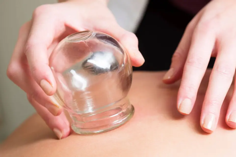 Cupping