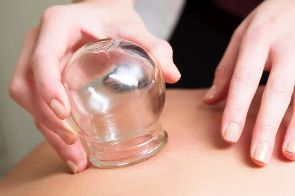 cupping-2 cupping-2